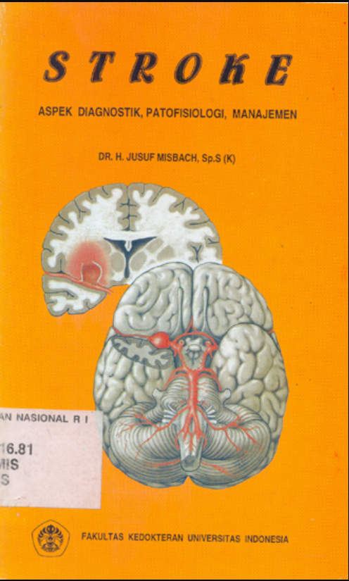 Stroke : aspek diagnostik patofisiologi, manajemen